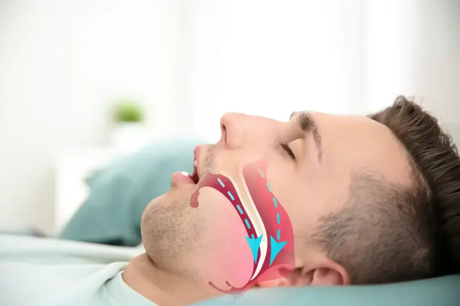Buy Anti Snoring Nasal Stent Online