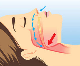 What to do about snoring? There are solutions...