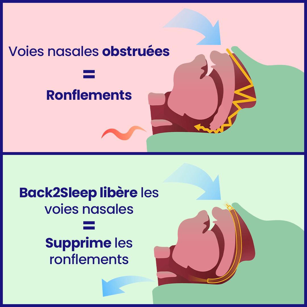 Starter Kit anti-snoring - Back2Sleep