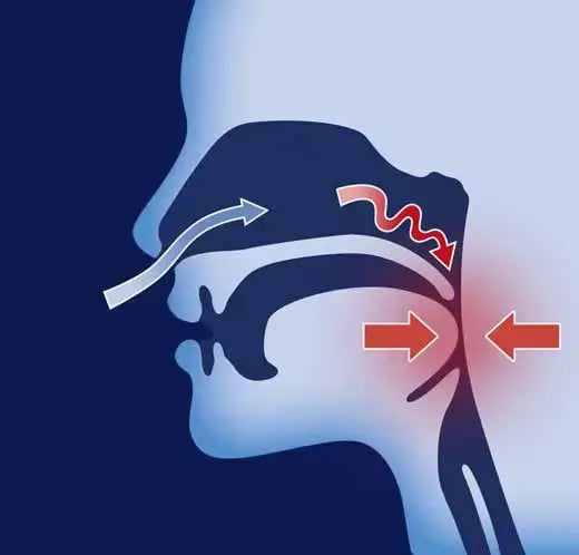 Anti-snoring in pharmacies: what to choose? full review! - Back2Sleep