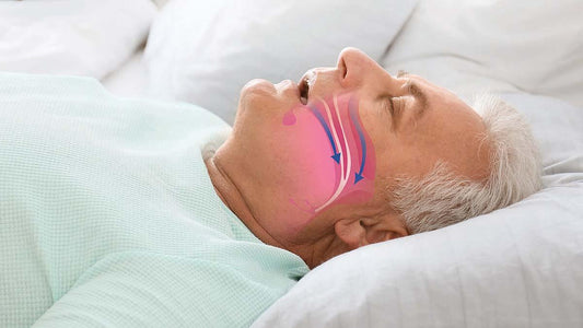 Understanding Obstructive Sleep Apnea Syndrome (OSAS)