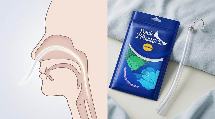 Turbinate Reduction vs Nasal Stent: Surgery or a Reusable Device for B - Back2Sleep