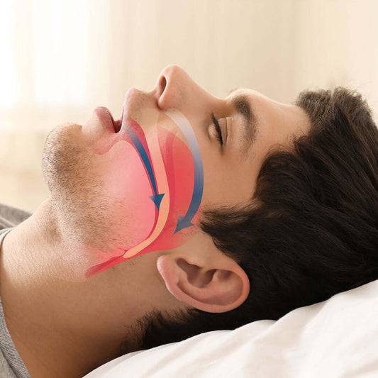 Portable Sleep Apnea Device